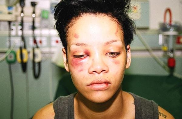 Rihanna'ya kalkan eller kırılsın.