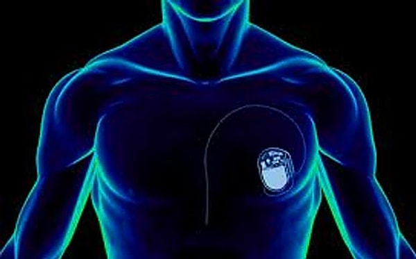 19. Разработан электрокардиостимулятор размером меньше, чем зерно риса.