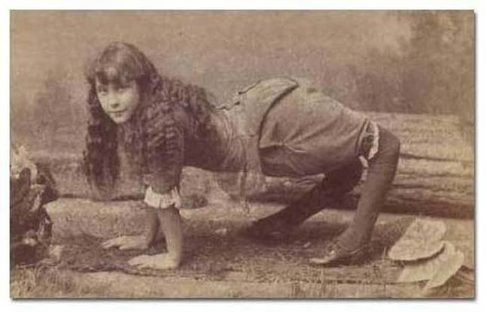 Fotoğraflarıyla Bile Sizi Dumurlara Sürükleyecek 5 Mutant İnsan