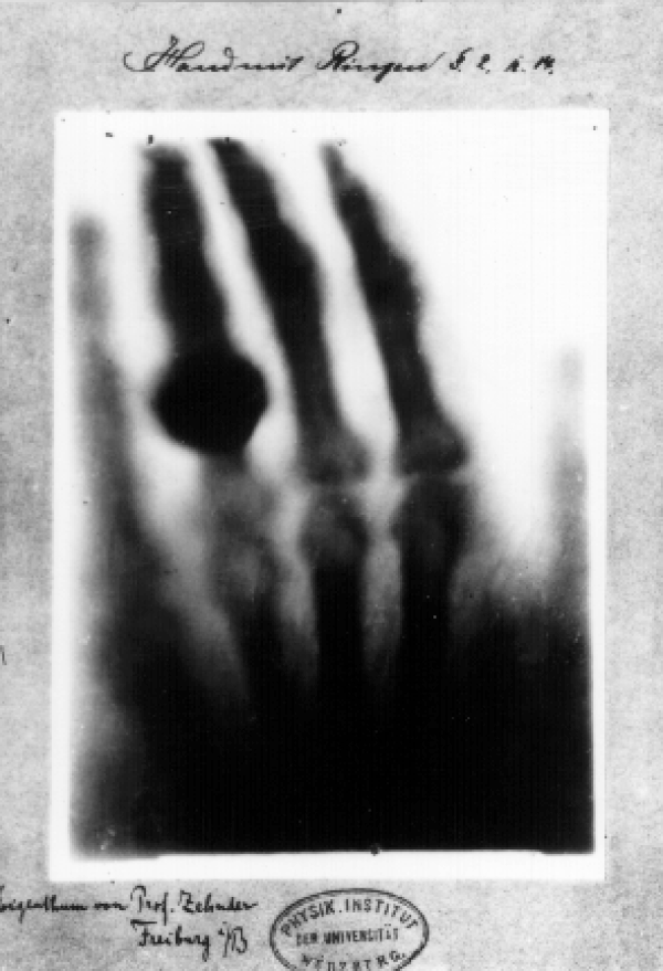 7. X-Işını fotoğrafı (Röntgen)