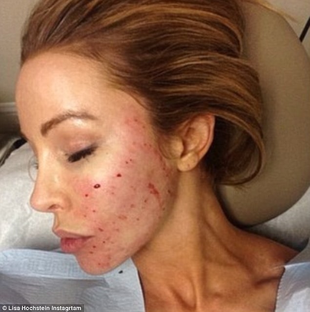 6. Lisa Hochstein