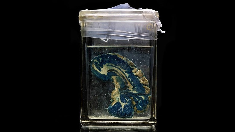 Üniversite Laboratuvarından 100 Beyin Çalındı