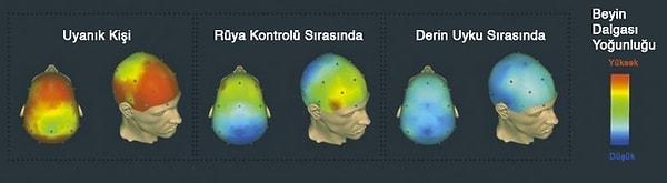 5. Farklı anlarda, 40 Hz beyin dalgalarının MRI görüntüleri: