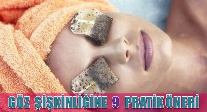 Göz Şişkinliğine 9 Pratik Öneri
