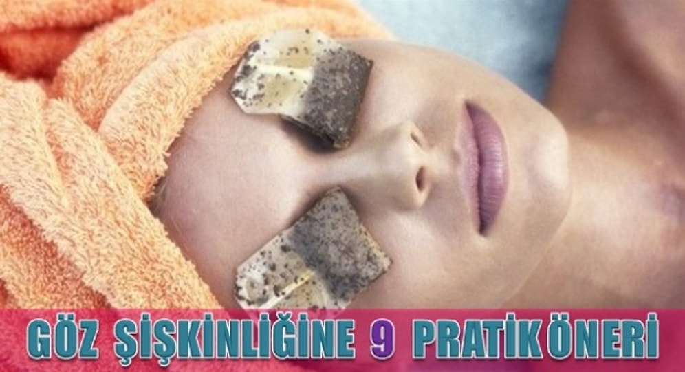 Göz Şişkinliğine 9 Pratik Öneri