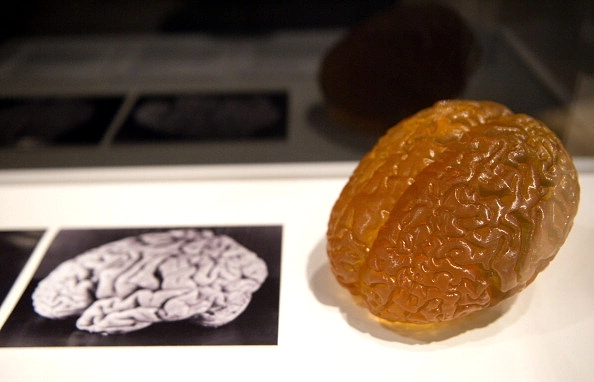 Teorik fizikçilerin teorisine göre beynin boyutu bir farklılık yaratmıyor. Örneğin Einstein'ın beyni 1.21 kilo ağırlığındaydı, ortalamadan bir hayli düşük.