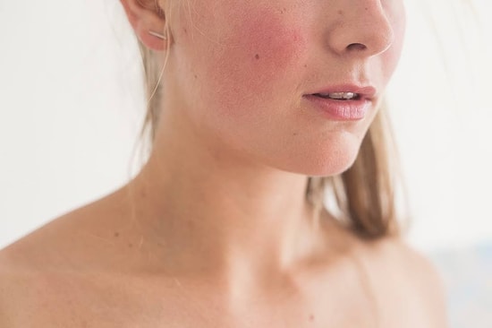 Danimarkalı Kadının 'İntikam Pornosu' Karşısında Verdiği "Çıplak" Mücadele