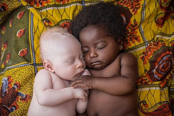 14. Siyahi bir bebek, albino bir bebeğin elini tutarken.