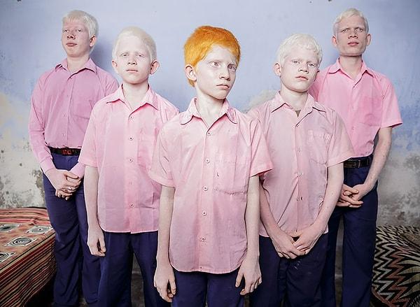 15. Hindistan'da Vivekananda Okulu'ndaki görme engelli albino öğrenciler.