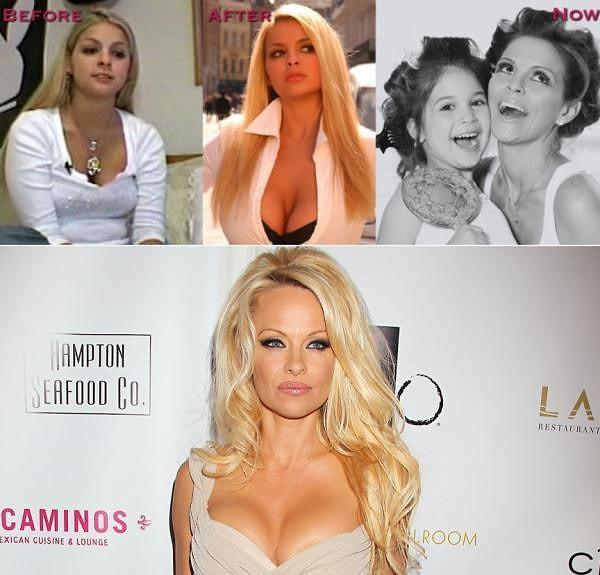 9. Sha Ross > Pamela Anderson