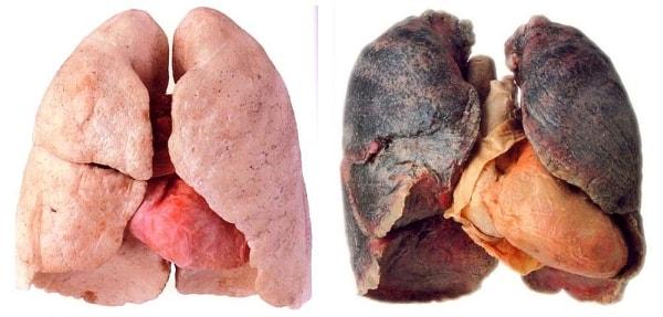 14. "Eğer çok sigara içmek akciğer kanserinde bir rol oynuyorsa bile, bu çok önemsiz bir roldür" –W.C. Heuper, Ulusal Kanser Enstitüsü, 1954.