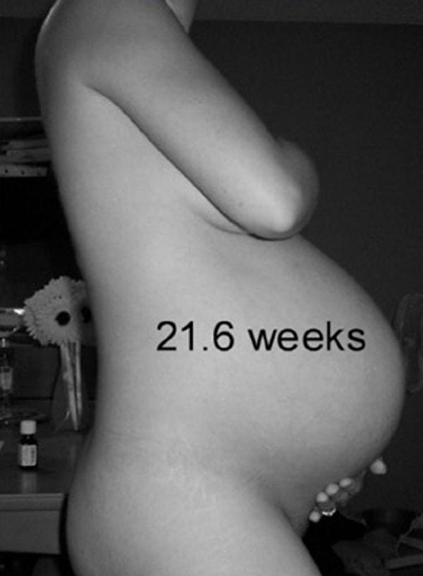 7. Yirmibirinci haftada; neredeyse tek çocuğa hamile olan bir insanın son fazına ulaşmış durumda