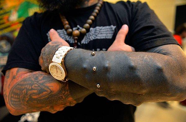 4. Venezuelalı Emilio Gonzalez, Lima'daki uluslararası dövme yaptıranlar buluşmasında, derisinin altındaki implantları gösteriyor.