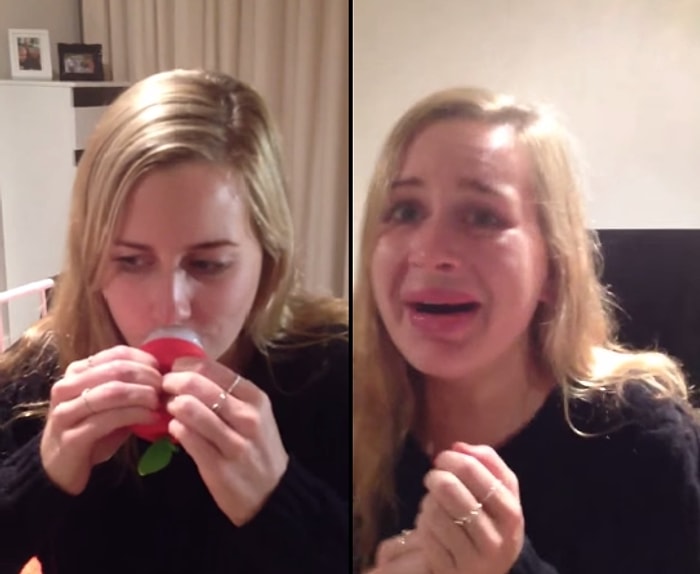 Dudak Dolgunlaştırıcısı Kullanan Kızın Dramı