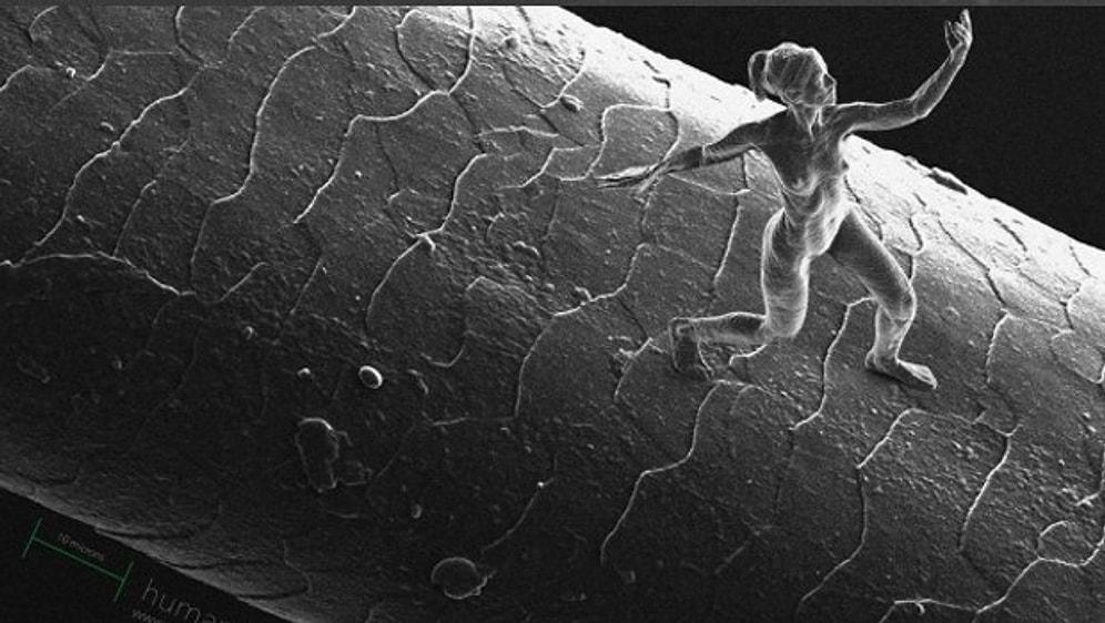 Vücudumuzun Mikroskobik Dünyasının Savaşlarını Gözler Önüne Seren 9 Etkileyici Görüntü
