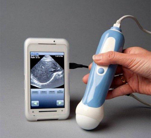3. Akıllı telefonunuza bağlayarak kullanabileceğiniz amatör bir ultrason cihazı