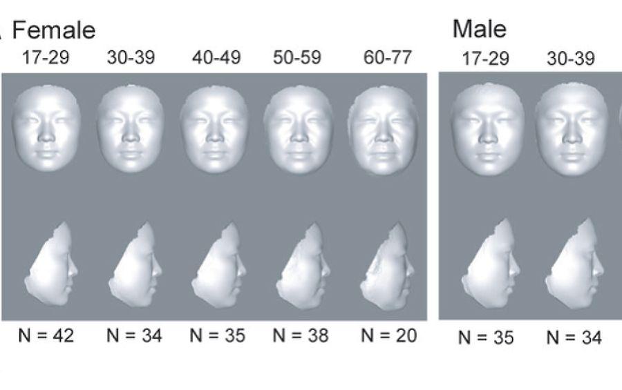 Возрастные изменения у мужчин. Изменение лица человека с возрастом. Форма лица меняется с возрастом. Возрастные изменения носа. Возраст по лицам.