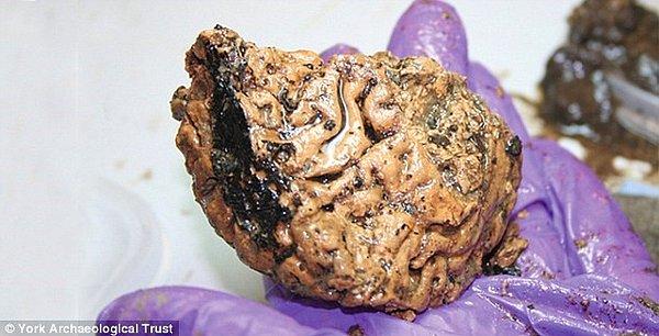 7. İngiltere’de 2600 Yıllık Korunmuş Beyin Bulundu