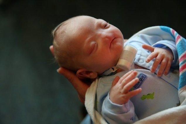 Eli Bebek, 4 Mart'ta burunsuz olarak dünyaya geldi. Bu, 197 milyonda bir gerçekleşen nadir bir olay..