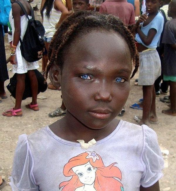 2. Haitili küçük kızın gözleri adeta bir mucize!