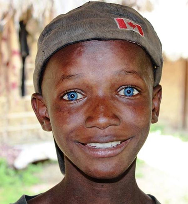 13. Ama Leone'nin annesi de mavi gözlere sahip