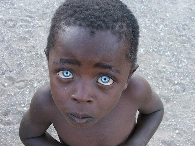 Evrenin Bir Mucizesi: Birbirinden Tatlı 17 Mavi Gözlü Siyahi Çocuk