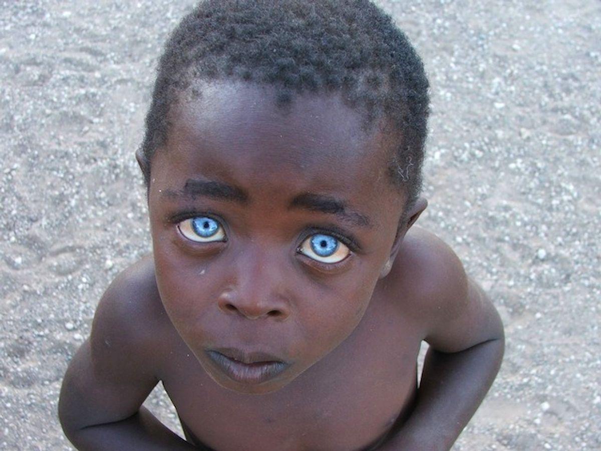 Темнокожий мальчик с голубыми глазами