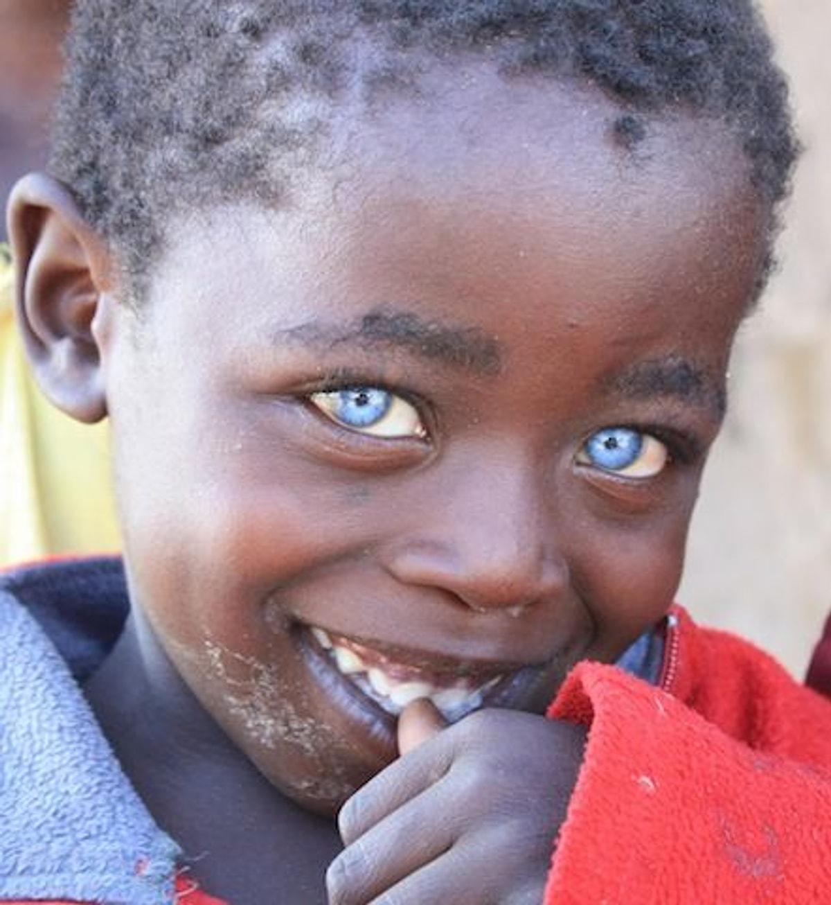 Африканка С Голубыми Глазами