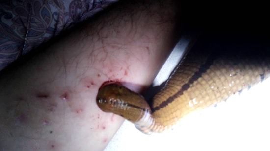 Evcil Hayvan Olarak Sülük Besleyen Rahatsız Adam