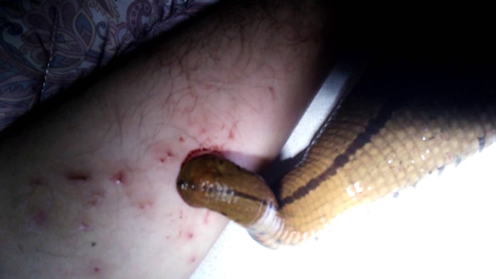 Evcil Hayvan Olarak Sülük Besleyen Rahatsız Adam