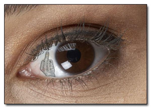 8. Göz küresi implantı