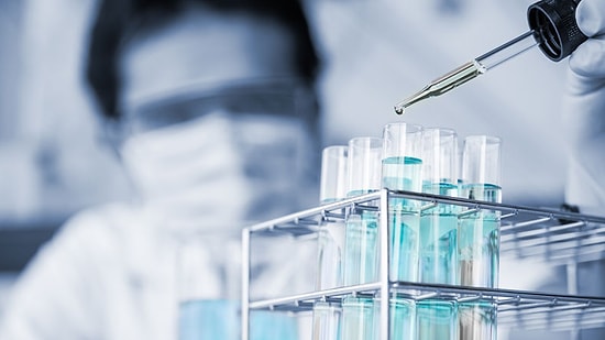 Kocaeli'de Domuz Gribinden Ölüm