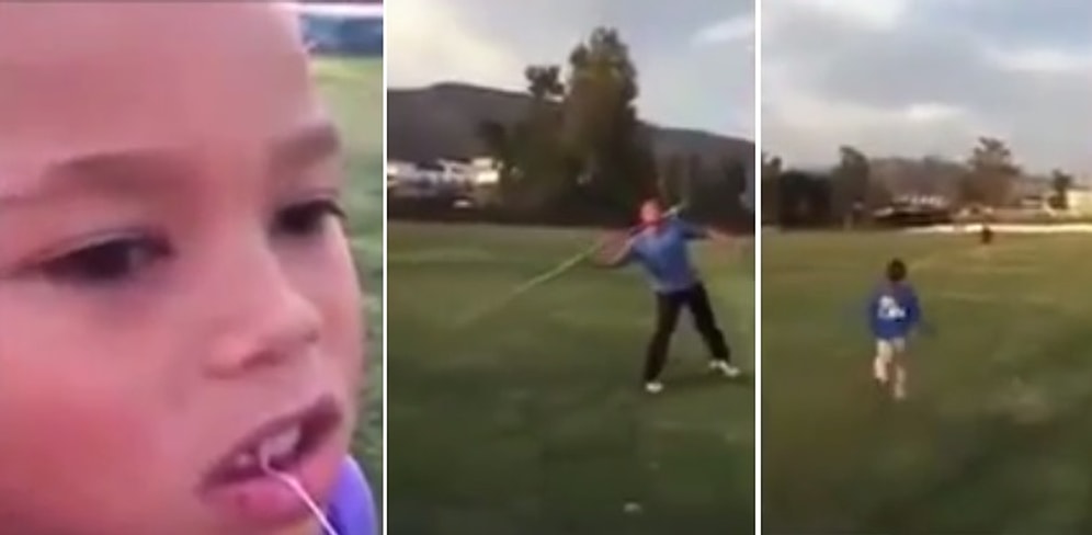 Ciritle Çocuğunun Dişini Çeken Adam