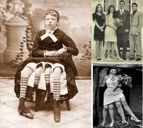 4 Bacaklı Kadınla Tanışın: Myrtle