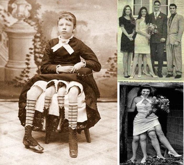 4 Bacaklı Kadınla Tanışın: Myrtle