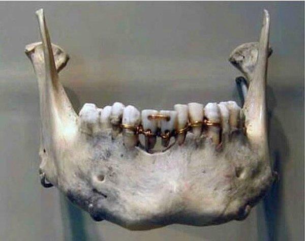 3. Milattan önce 2000 yılından kalma dünyanın en eski diş hekimliği çalışması
