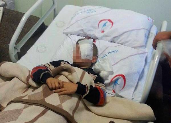 5. Cizre'de Polis 8 Yaşındaki Çocuğu Gözünden Vurdu