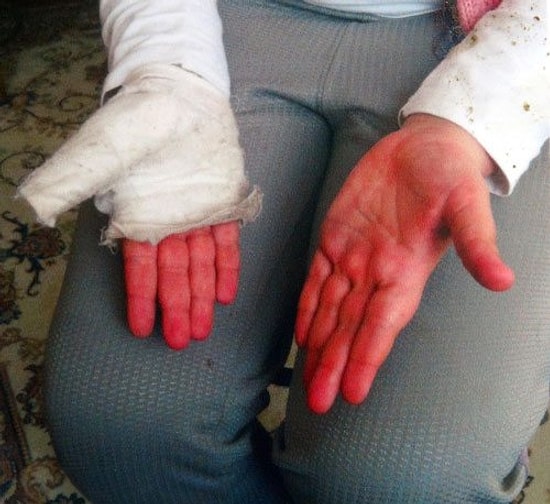 Kaymakamın Öğretmen Eşine, Dayak Soruşturması