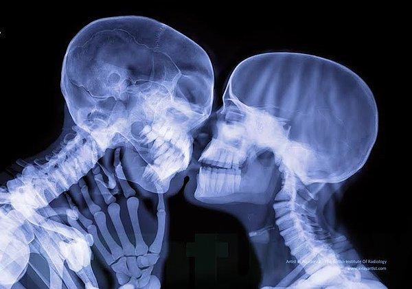 Eğer gerçekten düşünüyorsanız, öpüşmek kabaca kafatasınızın karşınızdakinin kafatasını ezmesi anlamına gelecek. Ama arada yumuşak bir doku var ve bu iyi hissetmemizi sağlıyor. X-ray formunda ise sıradışı göründüğü gerçek. Biz insanoğlu gerçekten çok garip varlıklarız...