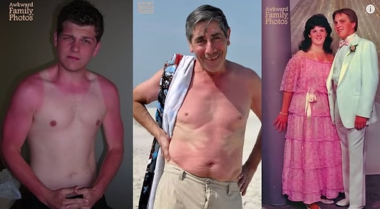 Güneşlenmeyi Yanlış Anlayıp Istakoza Dönen 11 İnsan