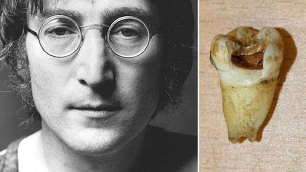 8. John Lennon'ın çürük dişi - 31.000 $