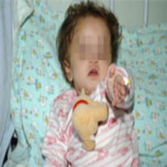 Bu ülkede daha 17 aylık N.N.B gibi, 3 tane hayvan tarafından işkence edilip tecavüze uğrayabilir, beyninizde ödem oluşabilir.