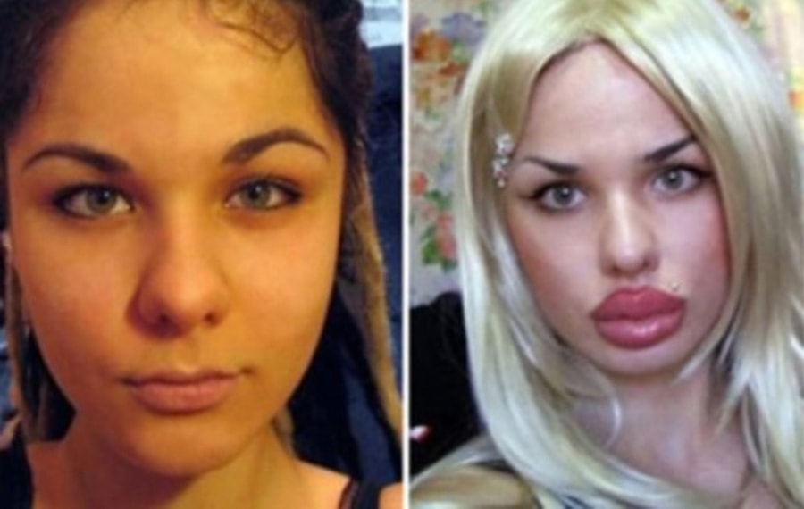 Supermaryface Plastic Surgery