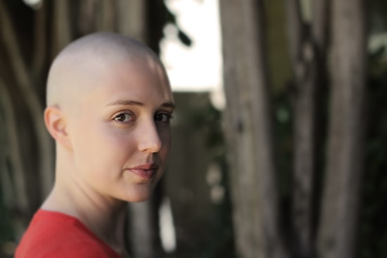 Baldvin: Alocepia Hastası Kadınlar Kellik Hakkındaki Klişeleri Yıkmak İstiyor