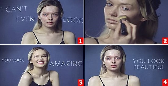 Asıl İğrenç Olanın İnternet Zorbalarının Yüzü Olduğunu Gösteren Sivilceli Kız