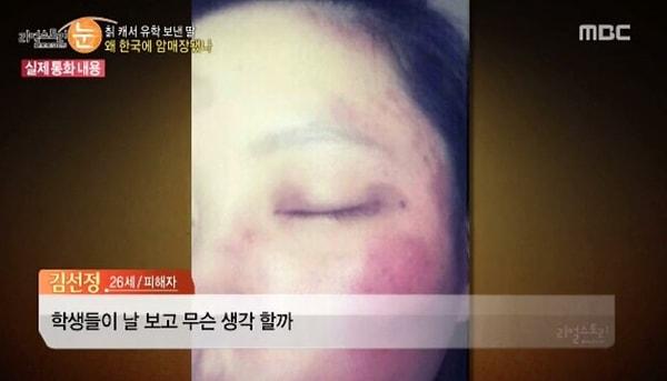 Geçen sene Kim’in yaralı vücudunun, mor gözlerinin ve kırılmış parmaklarının fotoğrafları, Lee’nin ona karşı olan kötü davranışlarının kanıtı olarak polise verilmiş ama hiçbir ceza uygulanmamış.