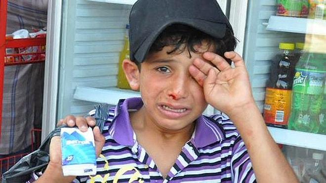 Mendil Satan Suriyeli Çocuğu Dövenler Hakkında Şikayet