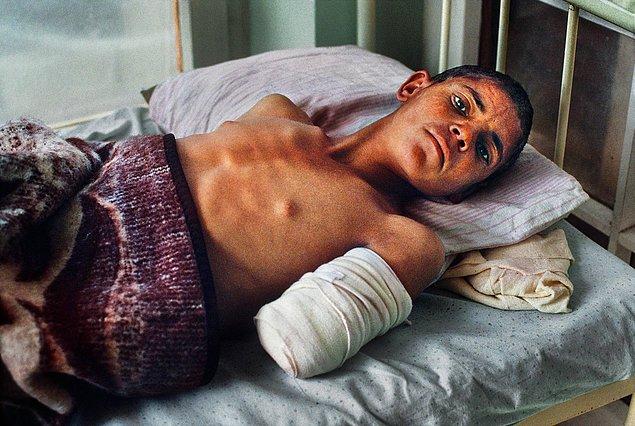 23. Savaş sebebiyle sol kolunu kaybeden bir çocuk, Kabil, Afganistan