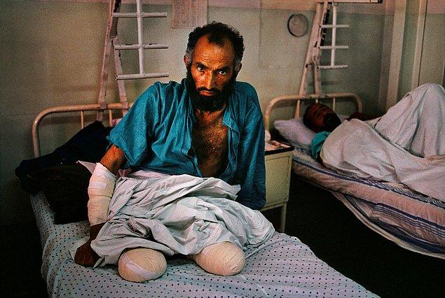 14. İki ayağını birden kaybetmiş Afgan bir adam