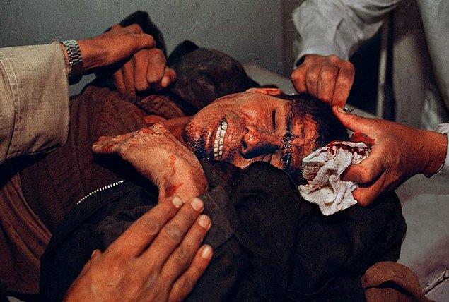 5. Yaralanmış bir genç, Kabil, Afganitan